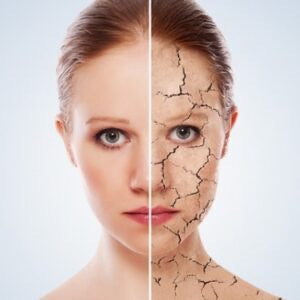 The Effects of Winter on the Skin