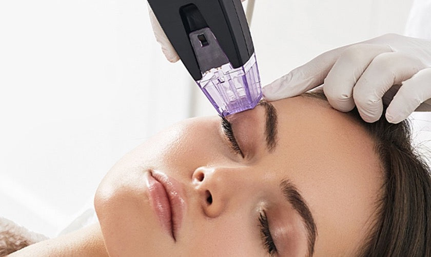 Morpheus8 for Face and Body