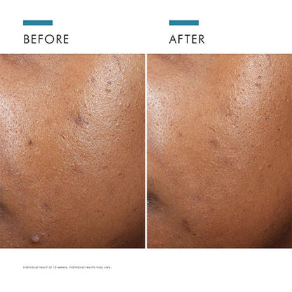 SkinCeuticals Phyto A+ Brightening Treatment