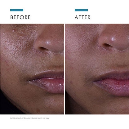SkinCeuticals Silymarin CF Serum