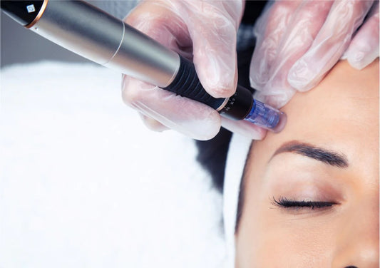 Micro-Needling Facial