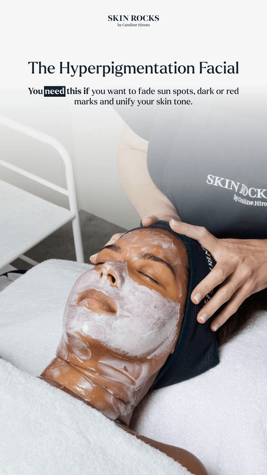 The Hyper Pigmentation Facial